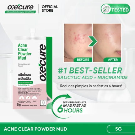 OXECURE 2% Salicylic Acid Acne Clear Powder Mud 5g [Pimples, blackheads, whiteheads clearing spot treatment & face mask; Fades dark marks and dark spots; For acne-prone skin] [Skin Repair Skincare]